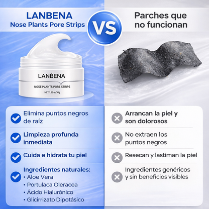 Lanbena® elimina puntos negros  y poros abiertos