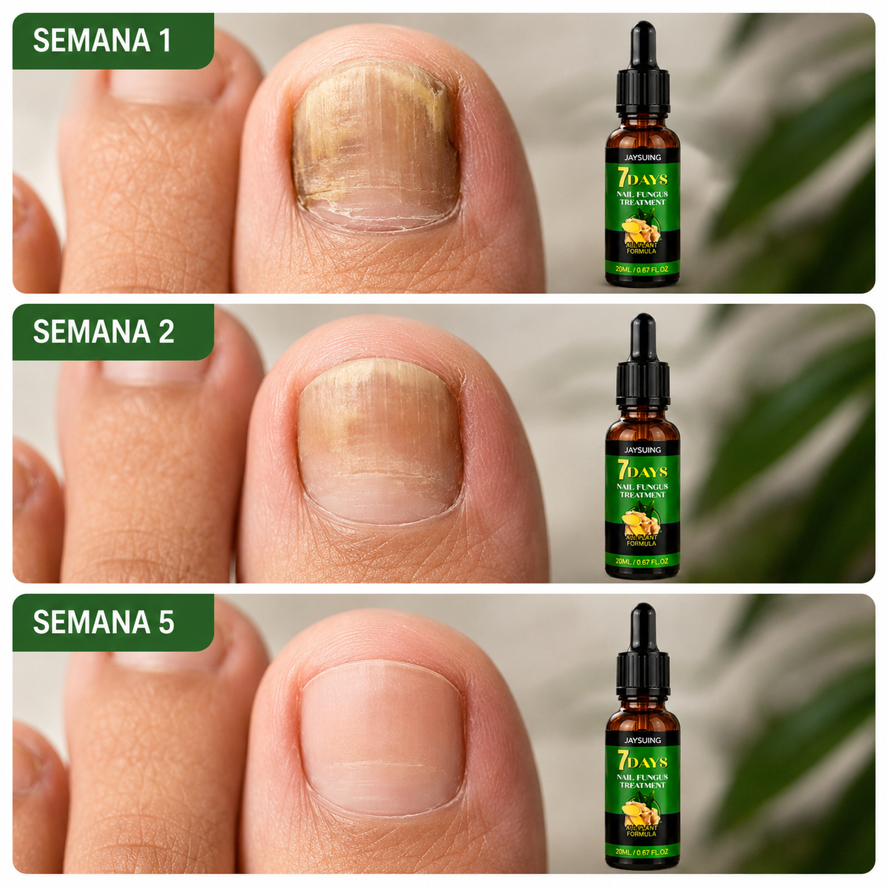 7 DIAS - ELIMINA LOS HONGOS DE UÑAS